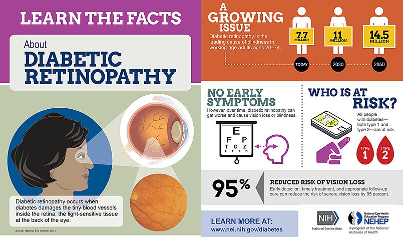 Diabetic Retinopathy Screening
